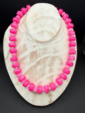 " Pinker Kluntje" – Pinke Perlenkette